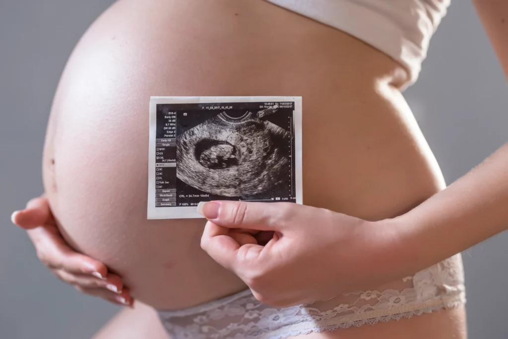 pregnant woman holding photo her future baby