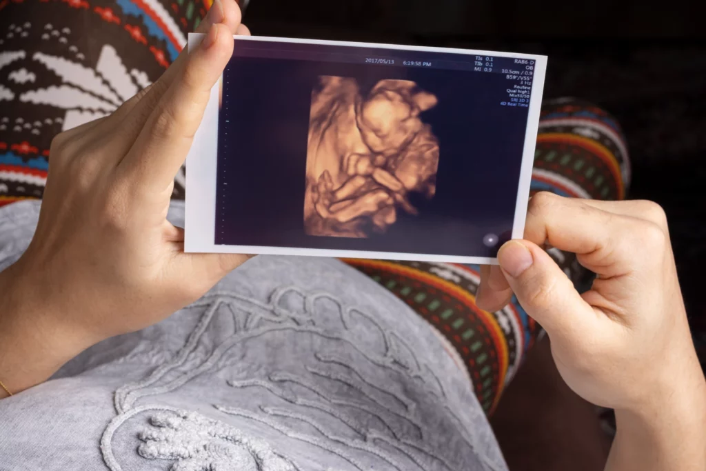 young mother holding unborn baby sonography 4d image hands resting sofa